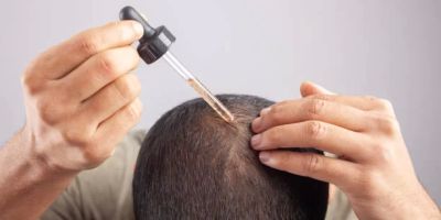 Best Online Pharmacy for Hair Loss Treatments in the USA